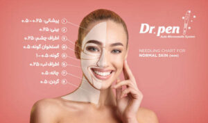 DrPen needling chart normal skin v1 600x600 Copy شرکت زیبایی سلامت دانژه