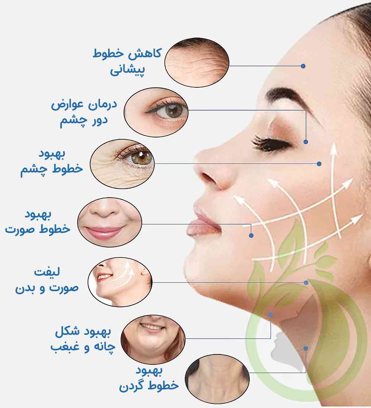 مزایای دستگاه RF صورت و بدن