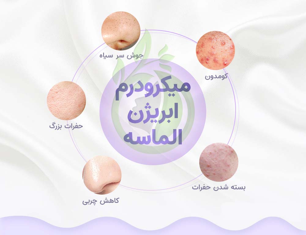 دستگاه میکرودرم ابریژن