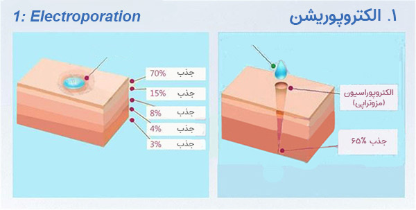 دستگاه الکتروپوریشن