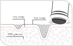 عملکرد کیت پلاژن