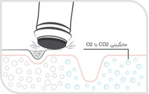 کیت پلاژن چیست