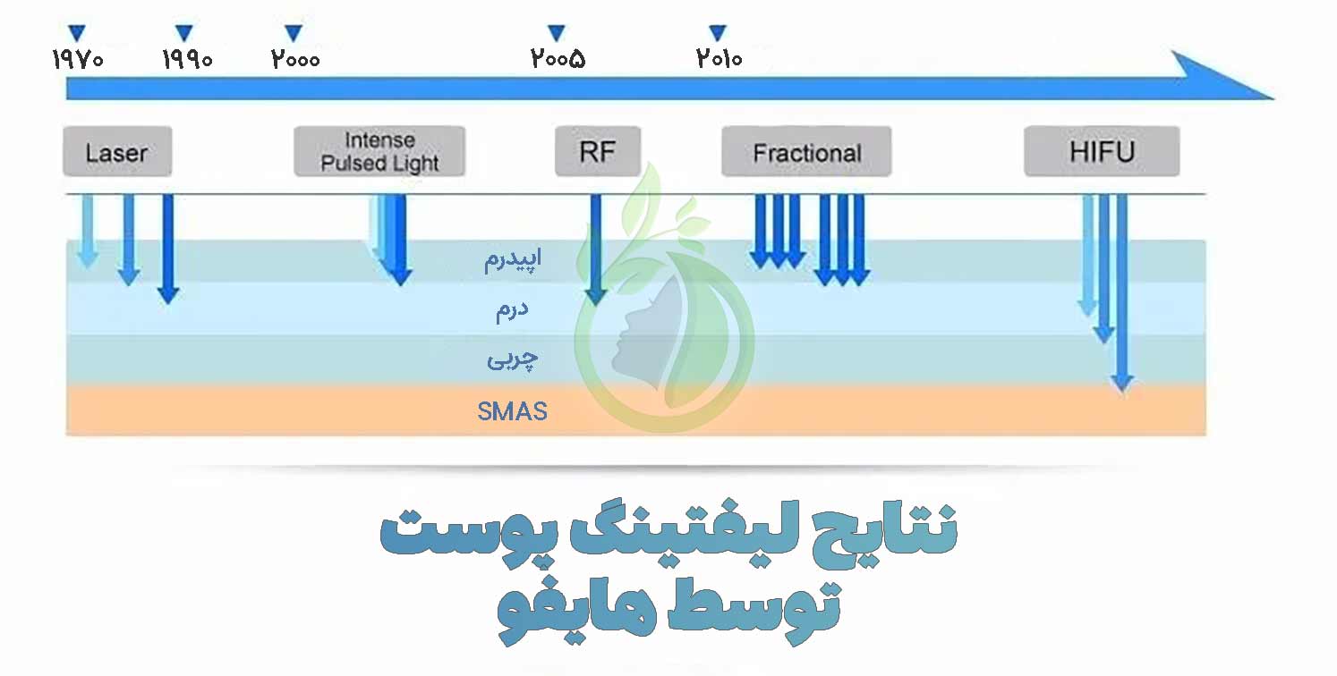 کارتریج دستگاه هایفو اولترا